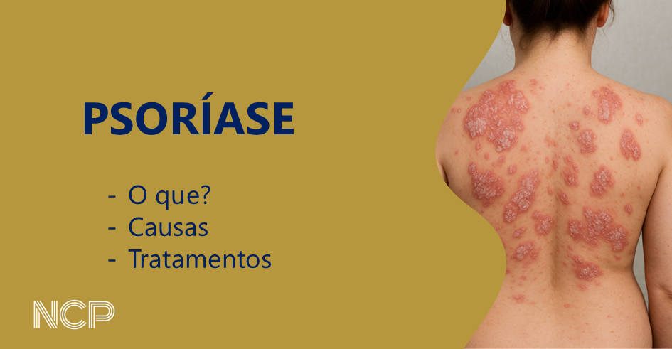 PSORÍASE