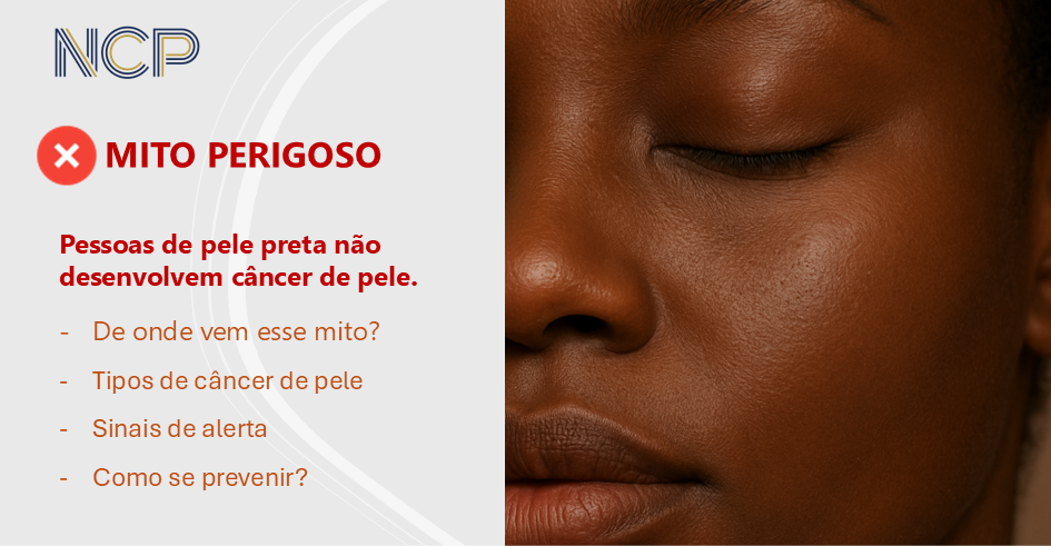 Pessoas de pele preta